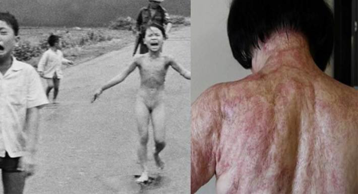 Aquí tenemos la icónica e impactante fotografía tomada por el corresponsal de guerra Nick Ut en la aldea de Trang Bang el 8 de junio de 1972.